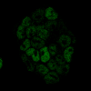 This time I used a chemical dye (kind of like paint) that glows green to coat a protein inside my cells; proteins are special chemicals that have different jobs around the cell!