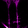 The patch clamp pipette is filled with a fluorescent dye that is injected into the neuron when I "patch" it