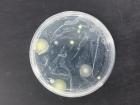 Fungal cultures from sea turtle nest sites grow quickly on a Petri dish in the lab
