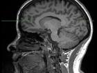 This is an MRI of my brain that I had done when I first started college. Can you name any parts of the brain?